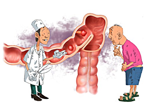Nguyên nhân đại tiện ra máu Nguyên nhân đại tiện ra máu