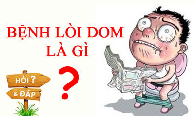 Bệnh lòi dom là gì?