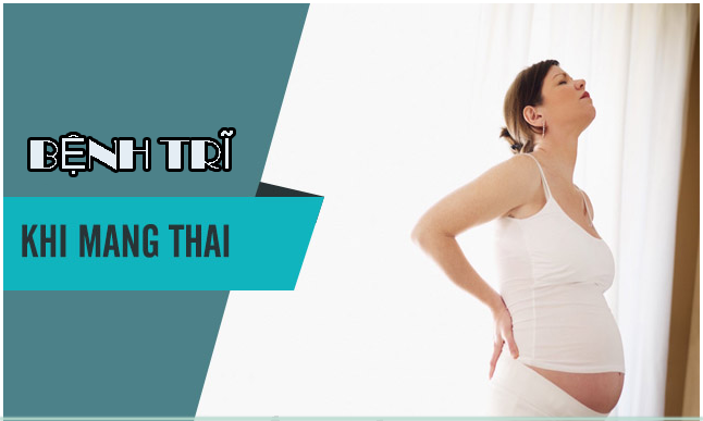 Bệnh trĩ khi mang thai