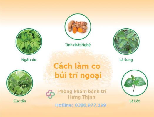 Cách làm co bui trĩ ngoại