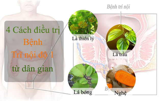 Điều trị trĩ nội độ 1 bằng cách dân gian