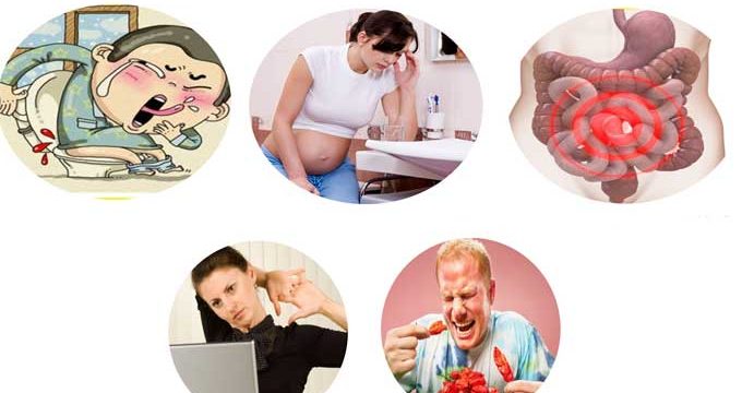 Nguyên nhân gây bệnh trĩ nội Nguyên nhân gây bệnh trĩ nội